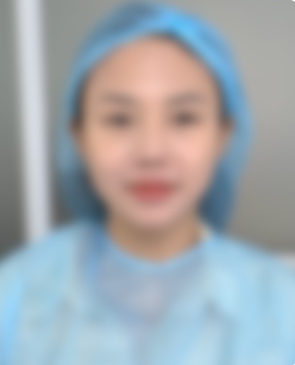 Ảnh mô phỏng sau điều trị