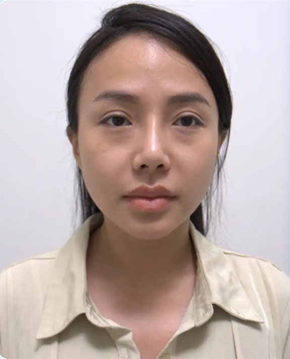 Ảnh trước